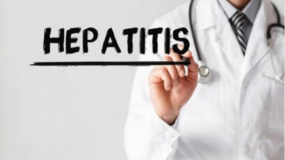 7 dari 18 Pasien Diduga Hepatitis Akut Meninggal Dunia, Ini Penjelasan RSPI Sulianti Saroso