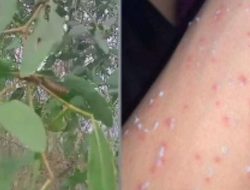 Ulat Bulu di Taman Bebaya Serang 12 Petugas DLH