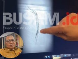 Dinkes Kaltim Ungkap Dokter Berinisial F Tangani Kasus Kawat Kateter Tertinggal di Tubuh Pasien AWS